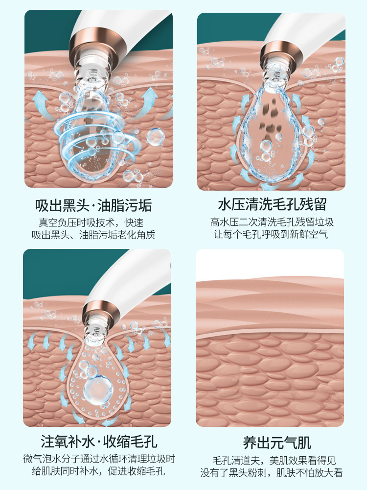 작은 거품 미용사는 숨구멍 청결한에서 국경을 교차하고 까만 머리 X13를 빨기 위하여 산소 유도 장치.