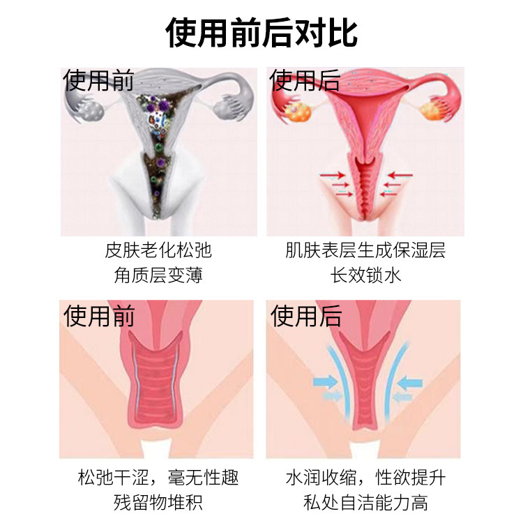 Đỉnh điểm phụ nữ, gel, tình dục và cuộc sống.