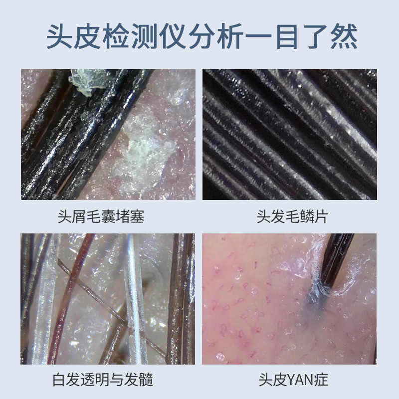 5G 무선 머리, 모피 가방 탐지기 와이파이, 고해상도 확대 인텔리전스 분석에 휴대폰을 연결 600 시간.