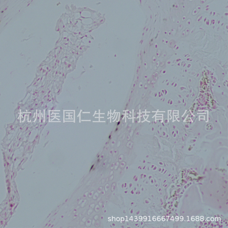 碱性磷酸酶染色（ALP） 组织样本病理技术服务