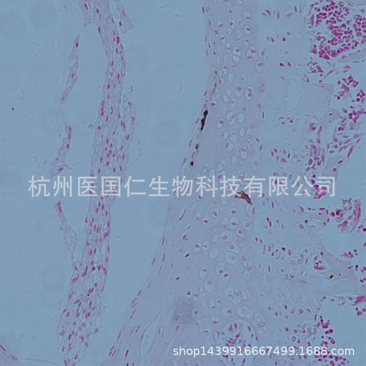 碱性磷酸酶染色（ALP） 组织样本病理技术服务