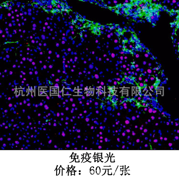 免疫荧光 组织样本病理技术服务