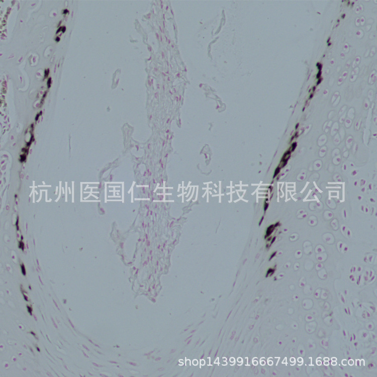 碱性磷酸酶染色（ALP） 组织样本病理技术服务