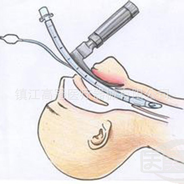 One-time use of a full-embracing tube intubation kit.