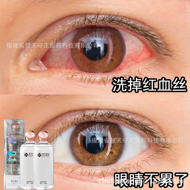 楚天眼业高级洗眼液唤醒型人工泪液清洁保湿洗眼水缓解眼睛疲劳