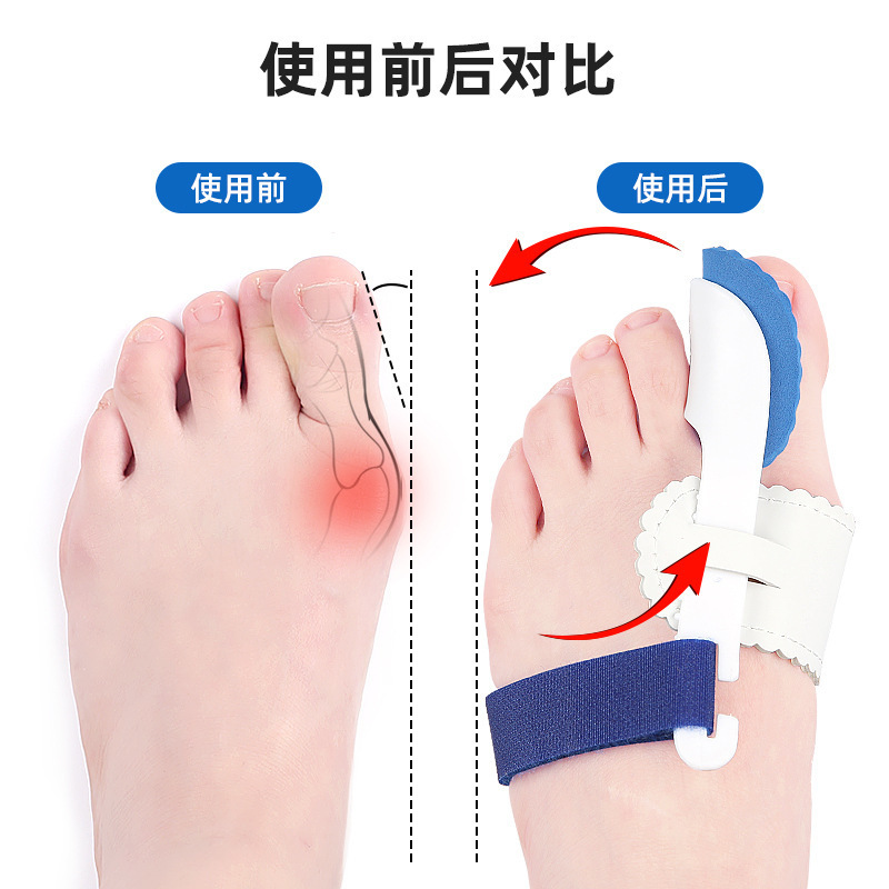 Một ngón tay cái lật/tip ngón cái lật/tamper ngón cái với ngón cái.