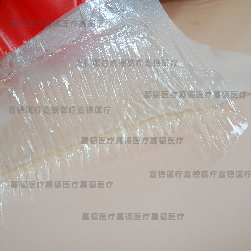 胸部凝胶敷贴 水凝胶 耗材 圆形带孔型15cm