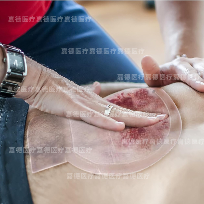 胸部凝胶敷贴 水凝胶 耗材 圆形带孔型15cm