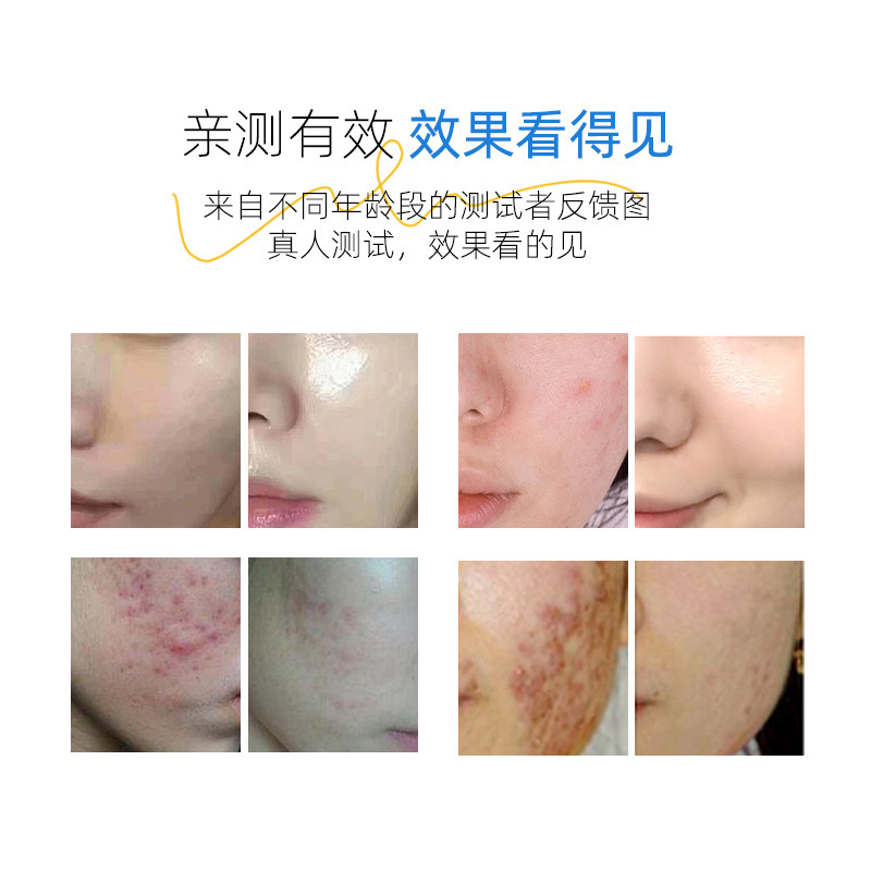 全能臭臭水三天焕肤提亮修护肌肤排解铅汞院线爆款