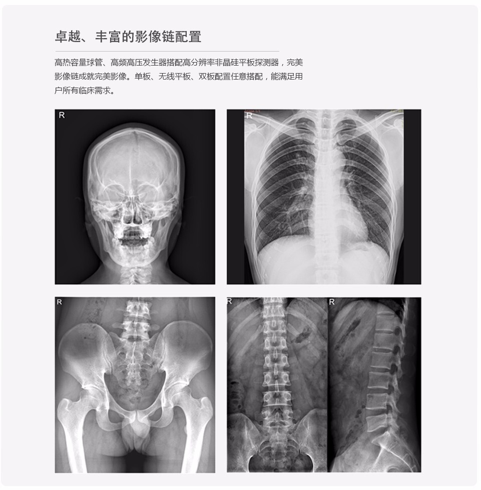 X-ray radial ultra-B in images of the multi-purpose digital X-ray photographic system suspended by the Deer Series