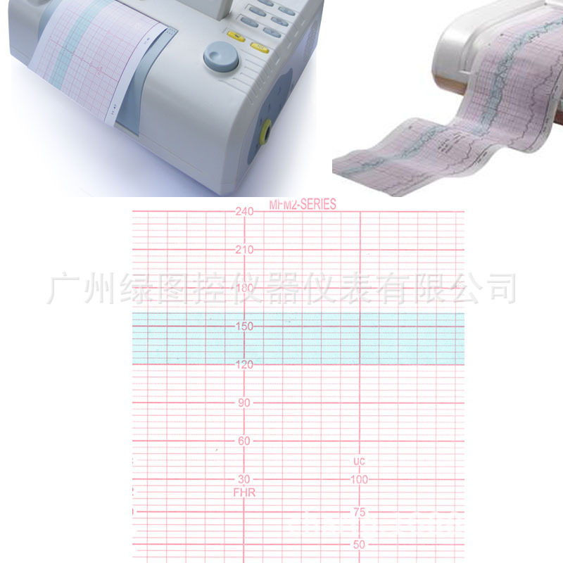 牛津胎监纸 SONICAID监护仪纸 索尼卡胎儿监护打印纸143X150-200P