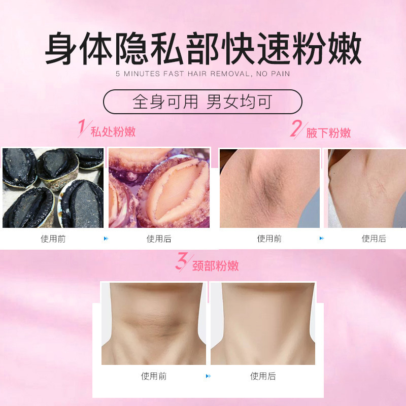 女性私处粉嫩去黑色素腋下乳头乳晕嫩红素女生私密处护理紧致工厂