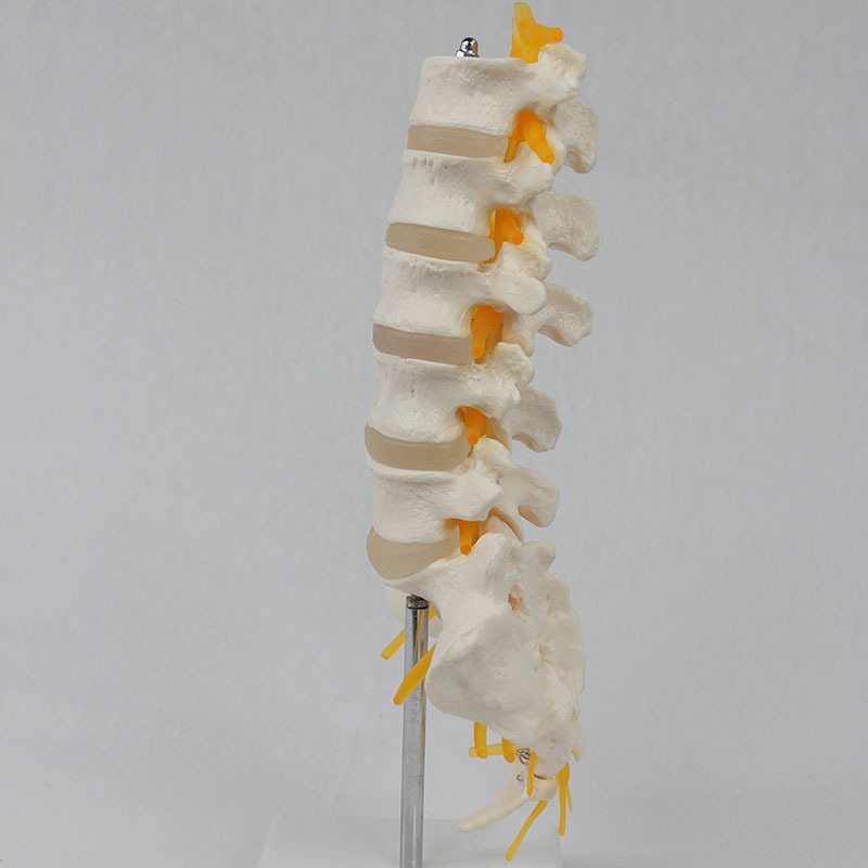 Five lumbar vertebraes open with a neuro-II model for teaching.