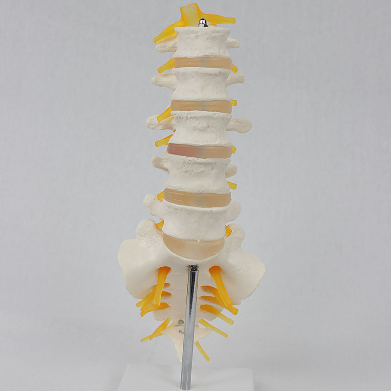 Five lumbar vertebraes open with a neuro-II model for teaching.