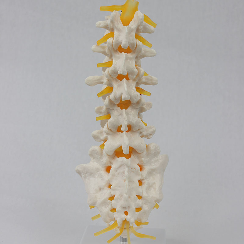 Five lumbar vertebraes open with a neuro-II model for teaching.