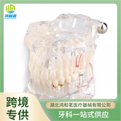 Dental consumption, mobile dental models, planting of dental models, disassembly oral restoration models, pathological dental models.