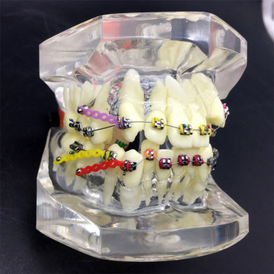 A crystal-teeth model, a larvae chain for teeth, a metal torque, a wrong bow and cheek tube, a malformation model.