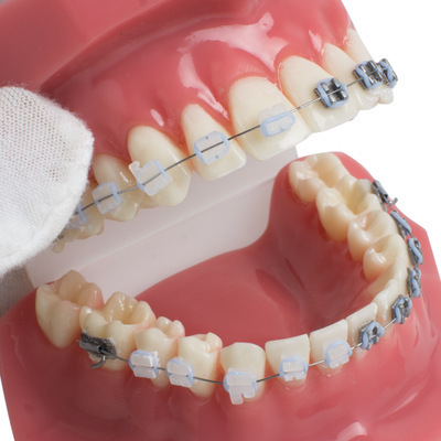 Dental belt metal troughs, orthodox red model teeth, pedagogue model.