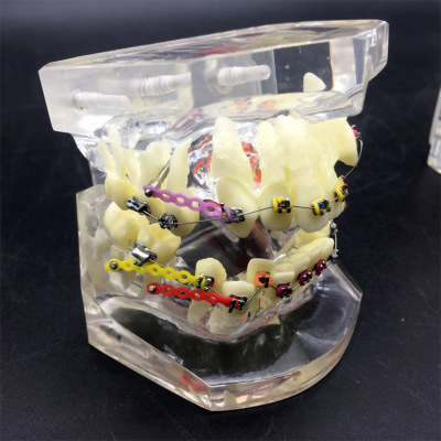 A crystal-teeth model, a larvae chain for teeth, a metal torque, a wrong bow and cheek tube, a malformation model.