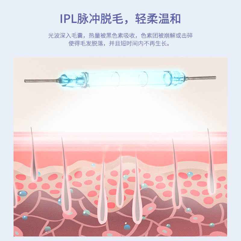 定制IPL脉冲氙灯脱毛仪嫩肤灯管ipl脉冲灯管冰点激光脱毛仪灯管