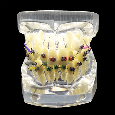 A crystal-teeth model, a larvae chain for teeth, a metal torque, a wrong bow and cheek tube, a malformation model.