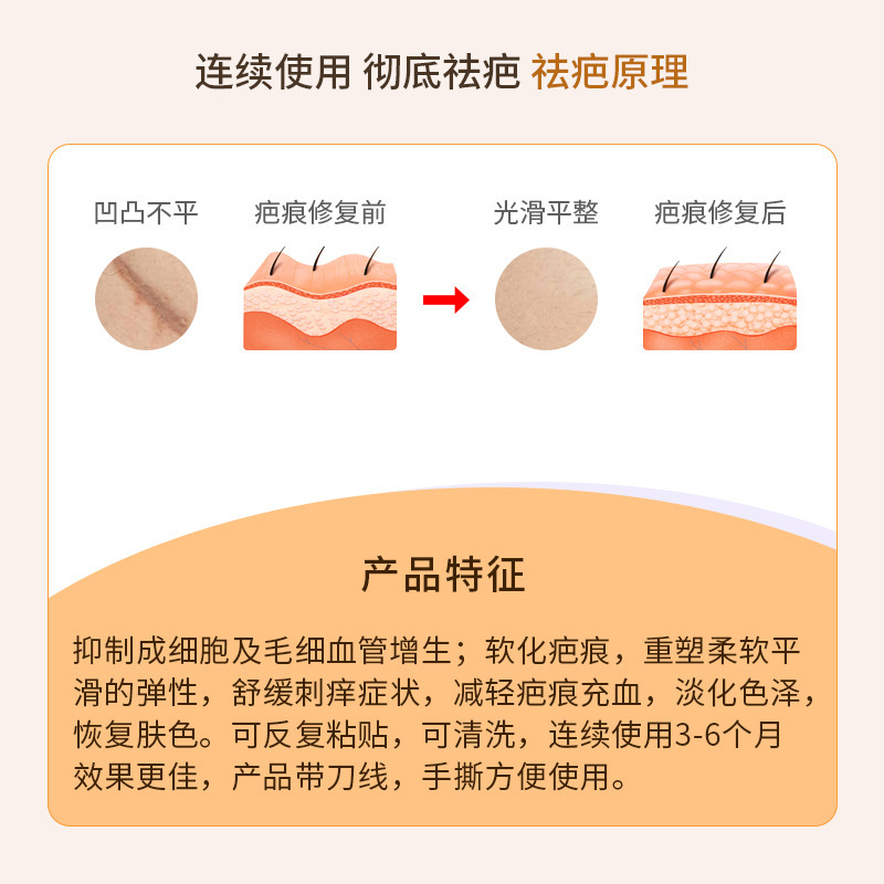 跨境特殊防水淡疤硅凝胶疤痕贴淡化阻燃凝胶加厚低敏修复贴胶带