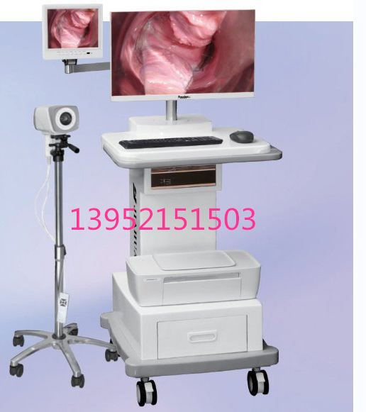 Single-screen electrovaginal mirror, push-by digital electrovaginal mirror manufacturer 13952151503.