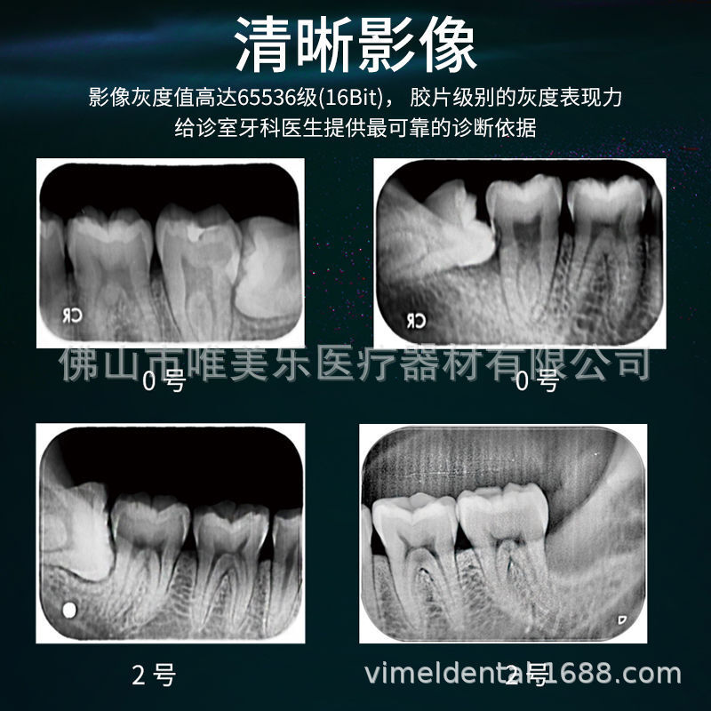 The dental tooth Q-600 X-ray machine, the image panel scanner, the high-resolution imager, the dental camera.