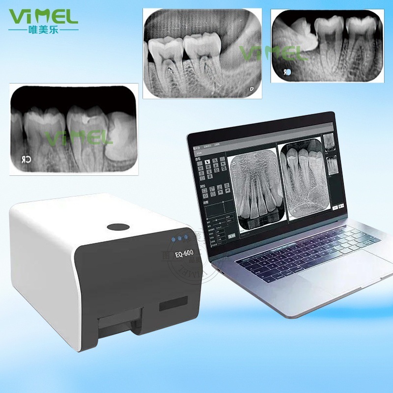 The dental tooth Q-600 X-ray machine, the image panel scanner, the high-resolution imager, the dental camera.