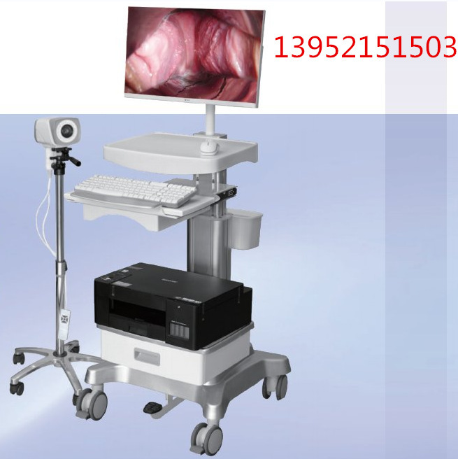 Single-screen electrovaginal mirror, push-by digital electrovaginal mirror manufacturer 13952151503.