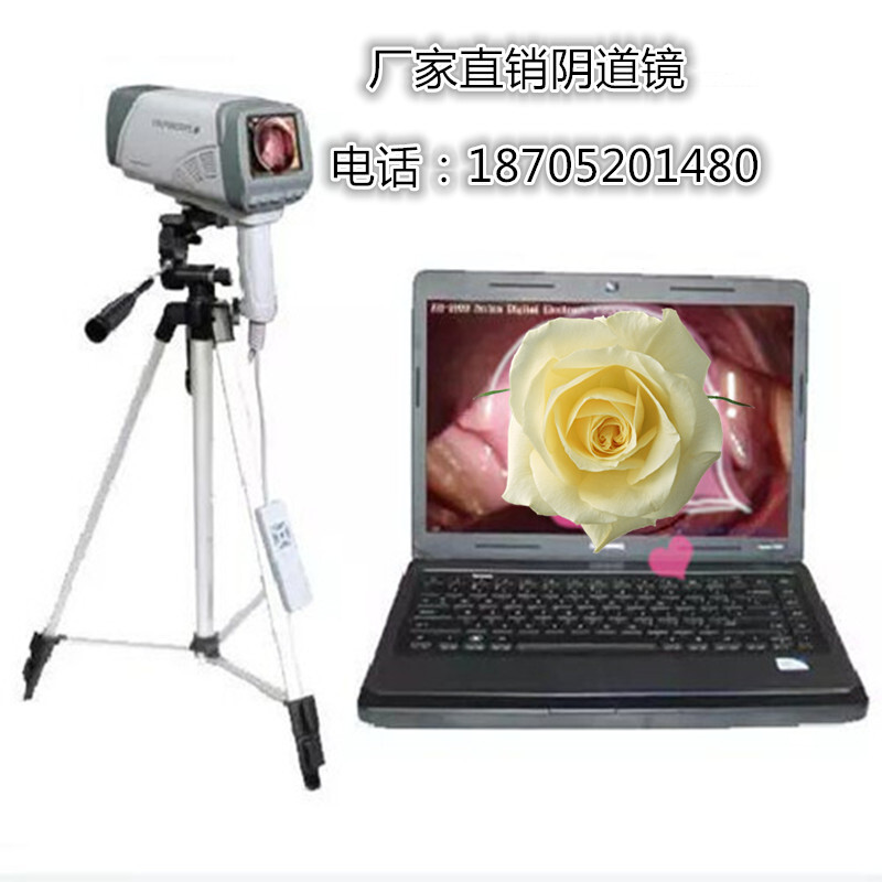 Digital vaginal gynaecology check for digital electrovaginal lens portable laptop high-clean vaginal mirrors