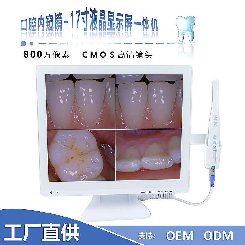 치과 감시자 구두 endoscope 높은 세척 물자를 위한 17 인치 감시자