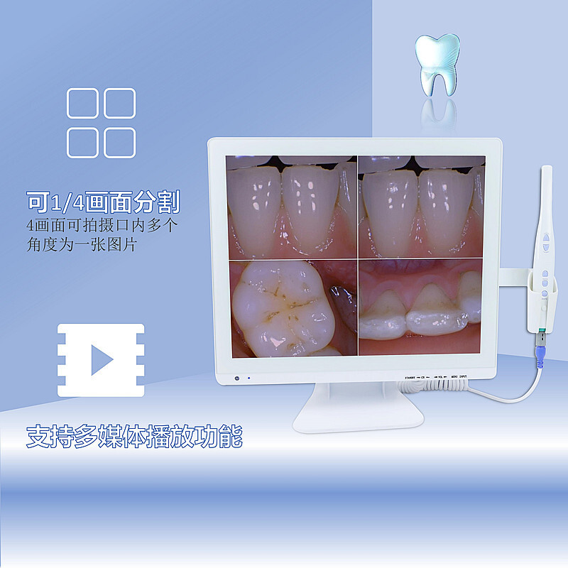 치과 감시자 구두 endoscope 높은 세척 물자를 위한 17 인치 감시자