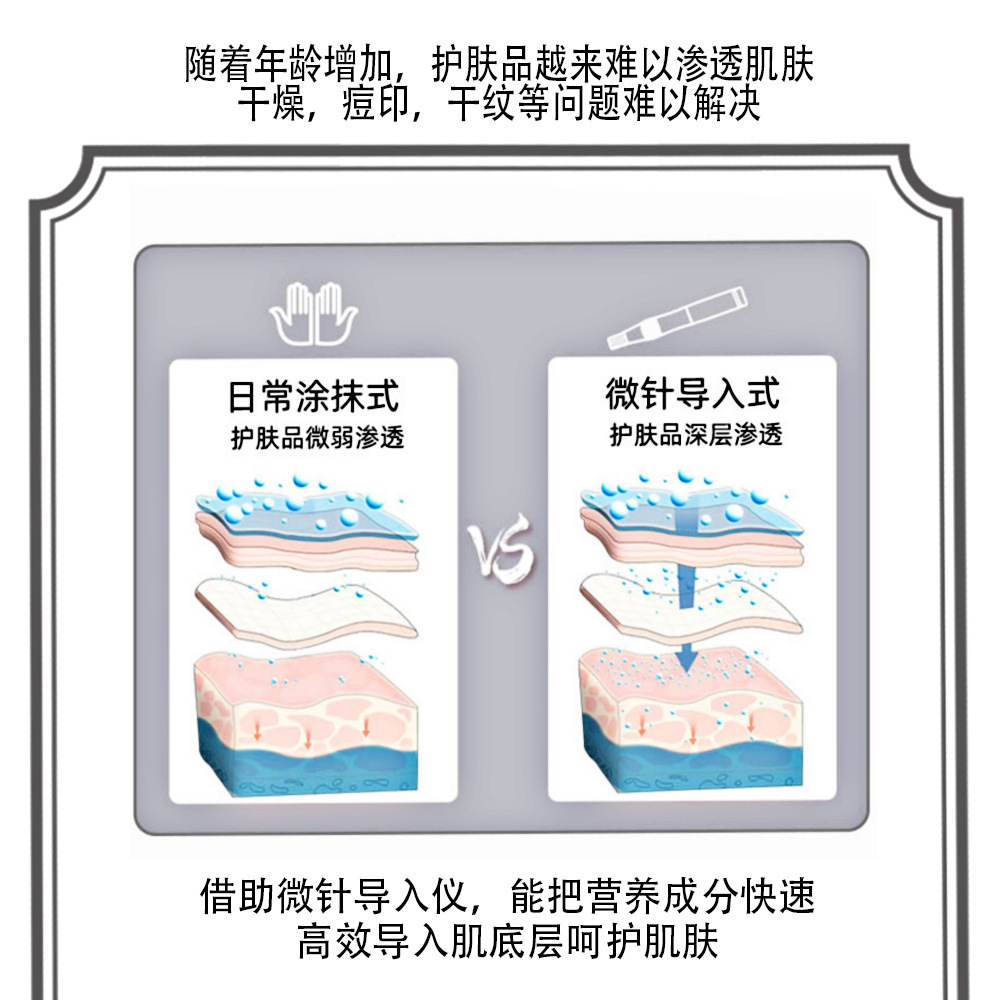 식물의 직접적인 힘 몬 microclinic 및 nanocrystal 바늘은 코르셋으로 수입됩니다.