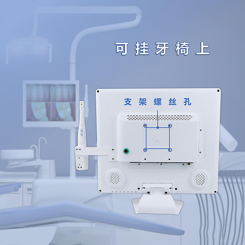 치과 감시자 구두 endoscope 높은 세척 물자를 위한 17 인치 감시자