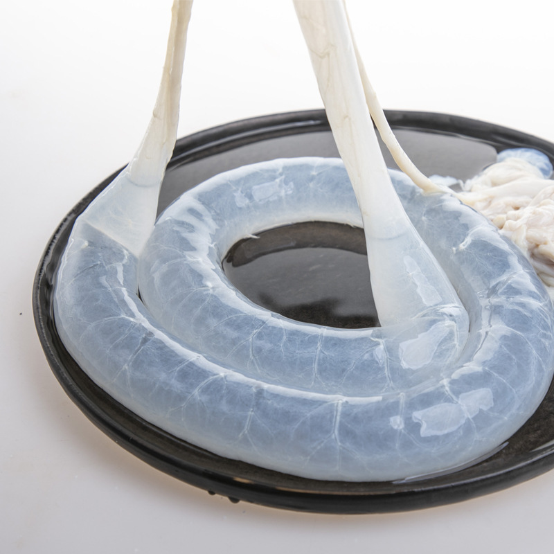 14 đường ruột và xúc xích.