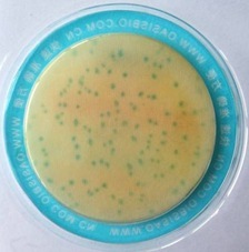 Sakazaki Bacillus. Sakazaki Bacillus.